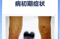 山东济南增15例阳性感染者（艾滋病病人和艾滋病病毒感染者阳性）