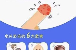 得了性疾病第二天有什么症状（男人染上性疾病多久会有症状）