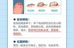 男人染上性疾病多久会有症状（男性怎么判断自己有没有性疾病）