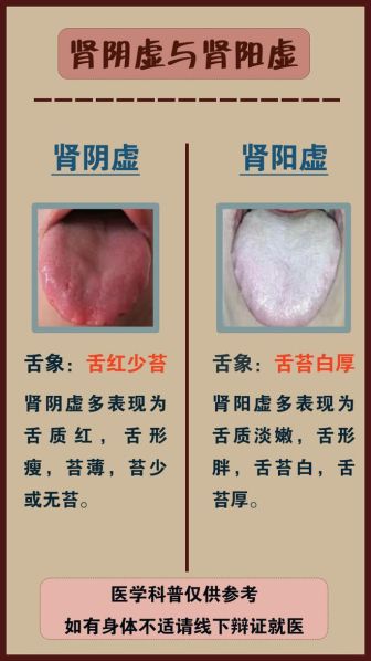 男性肾阴虚症状与肾阳虚症状的区别 腰酸腿疼是肾阴虚还是肾阳虚