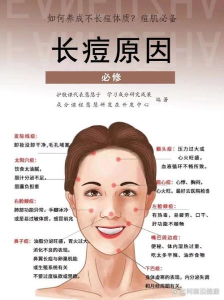 中医治疗痘痘的方法 中医祛痘最有效的方法