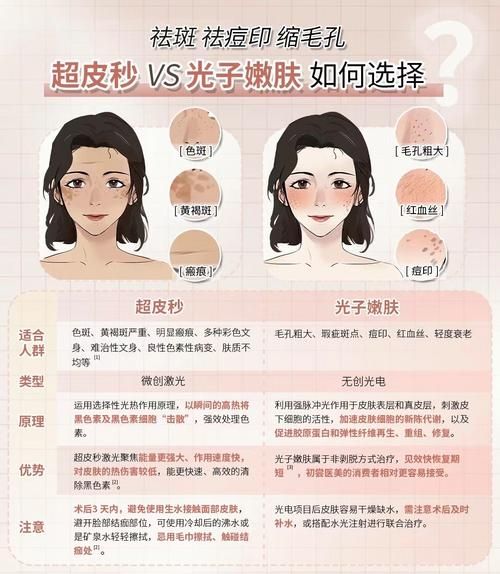 超光子和超皮秒的价格 光子祛斑效果好?还是超皮秒好