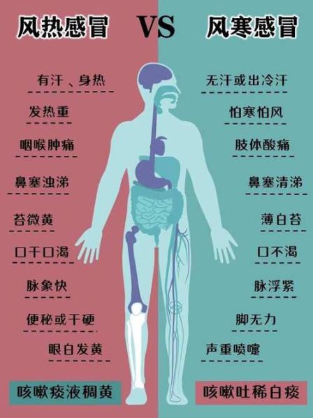 风寒感冒和病毒感冒的区别和症状图片对比 风寒面瘫与病毒面瘫症状区别