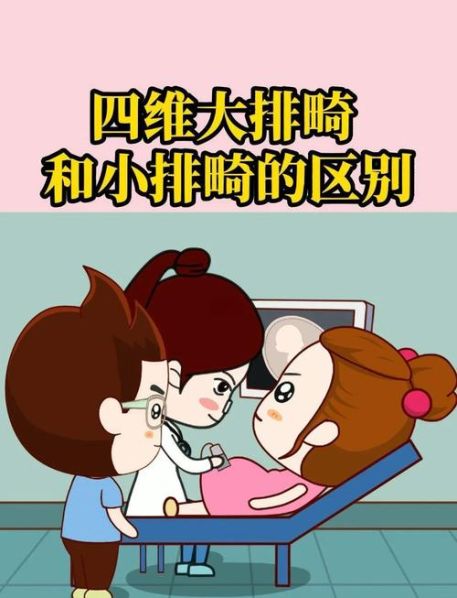 大排畸和4维的区别 大排畸是四维彩超吗