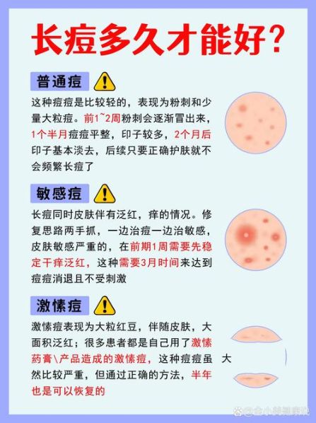 有没有让痘痘快速成熟的方法 如何让脸上的痘痘消失