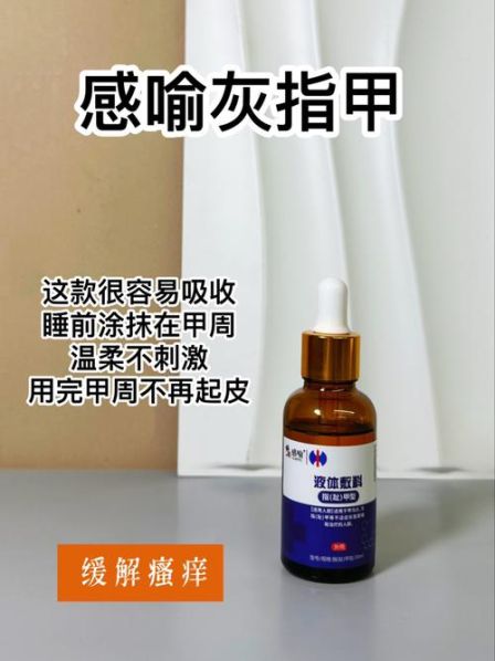 灰指甲根治的方法 灰指甲的治疗方法用醋