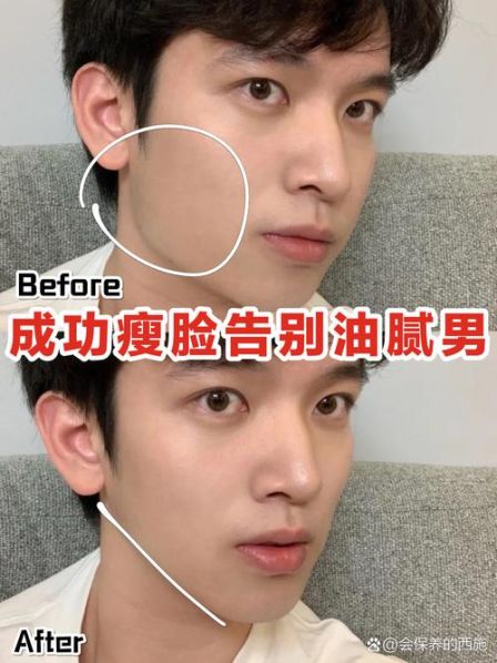 男士瘦脸最简单的方法图片 男生如何自然瘦脸