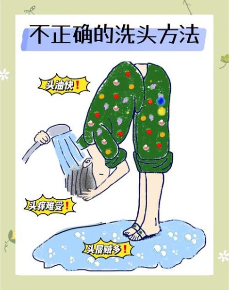 去头皮屑的方法小孩专用的方法 小朋友头皮屑怎么去除