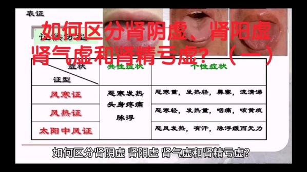 男性肾阳虚和阴虚的区别图片 男人肾阳虚和阴虚最正确的判断方法