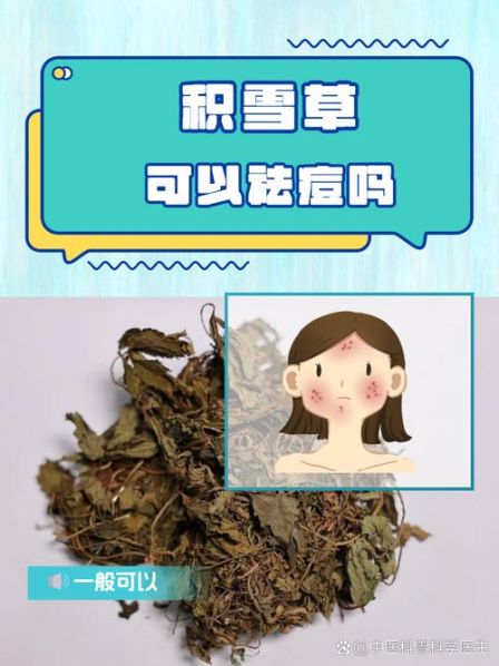 快速去痘痘的方法：快速去痘痘的方法中药