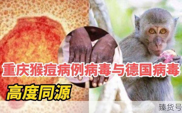 重庆猴痘病例与德国病毒高度同源（猴痘病毒的临床症状）