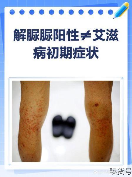 山东济南增15例阳性感染者(艾滋病病人和艾滋病病毒感染者阳性)